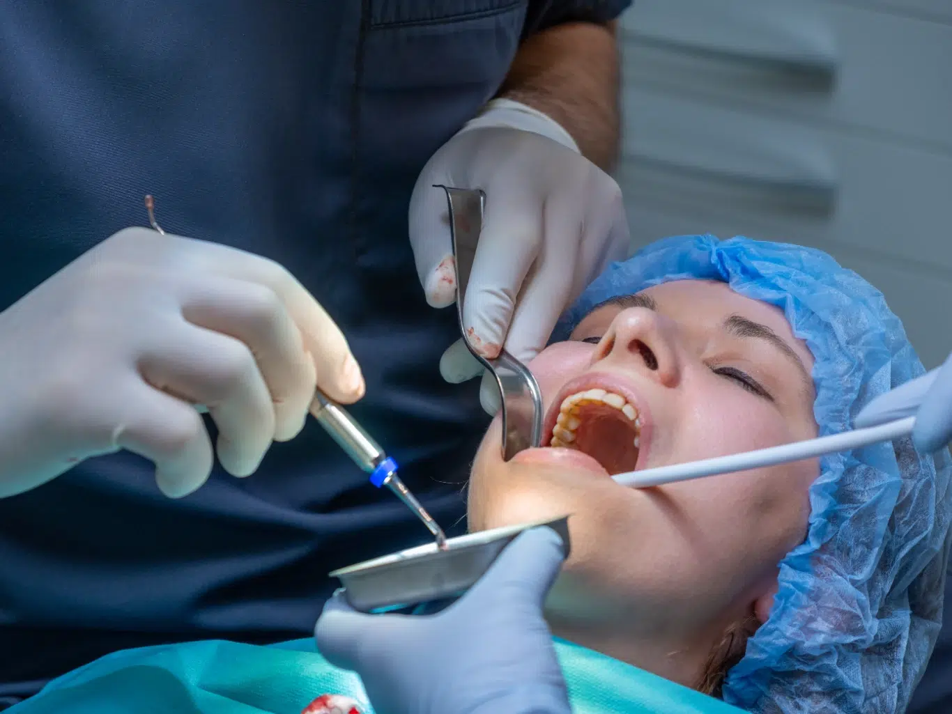 A close up clinical view of a patient undergoing oral surgery